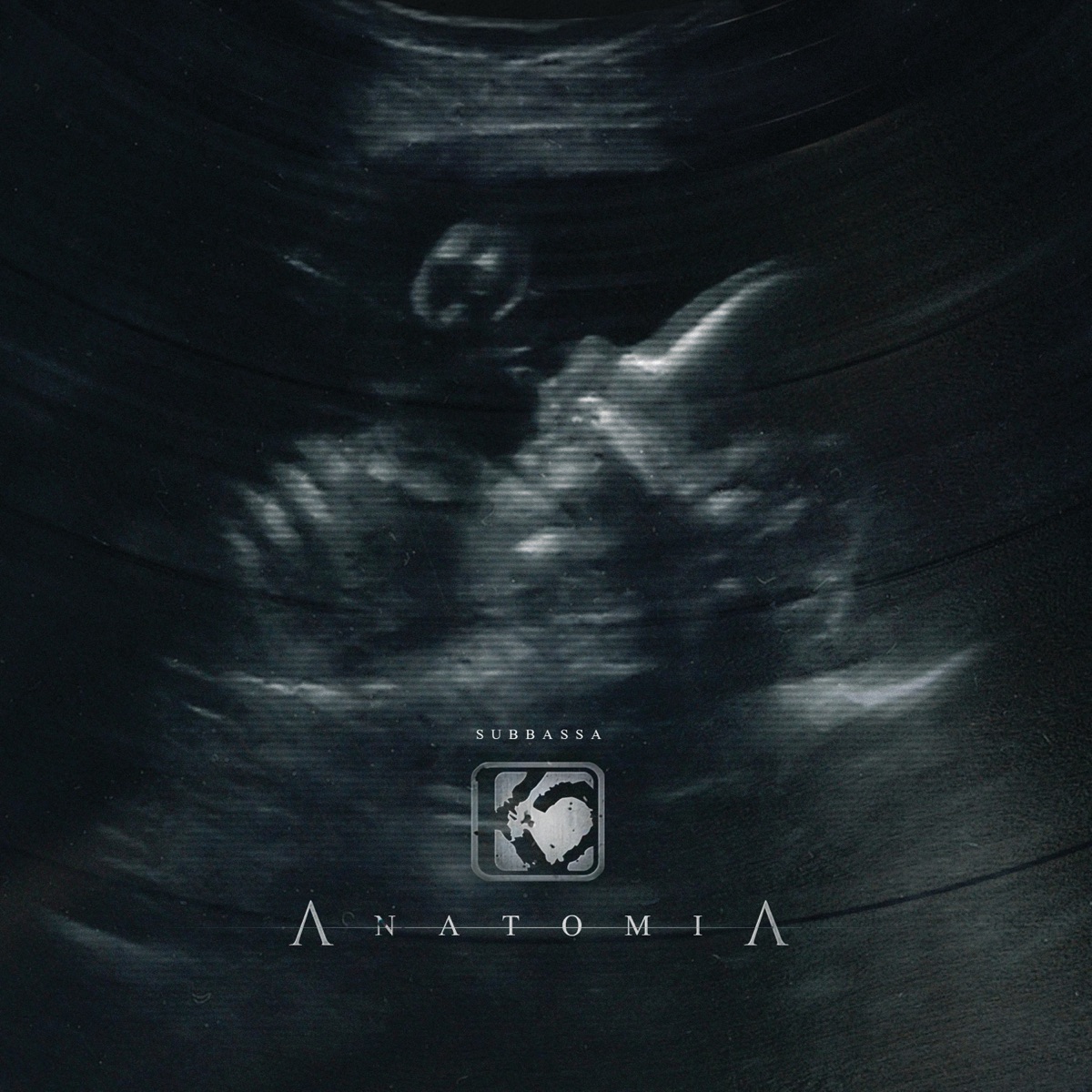 Anatomia by K2 album cover