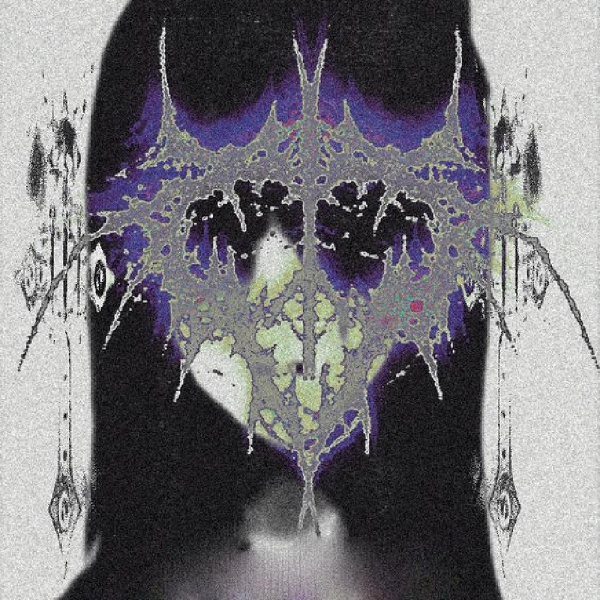 Abnormal - Single by RXSCX album cover