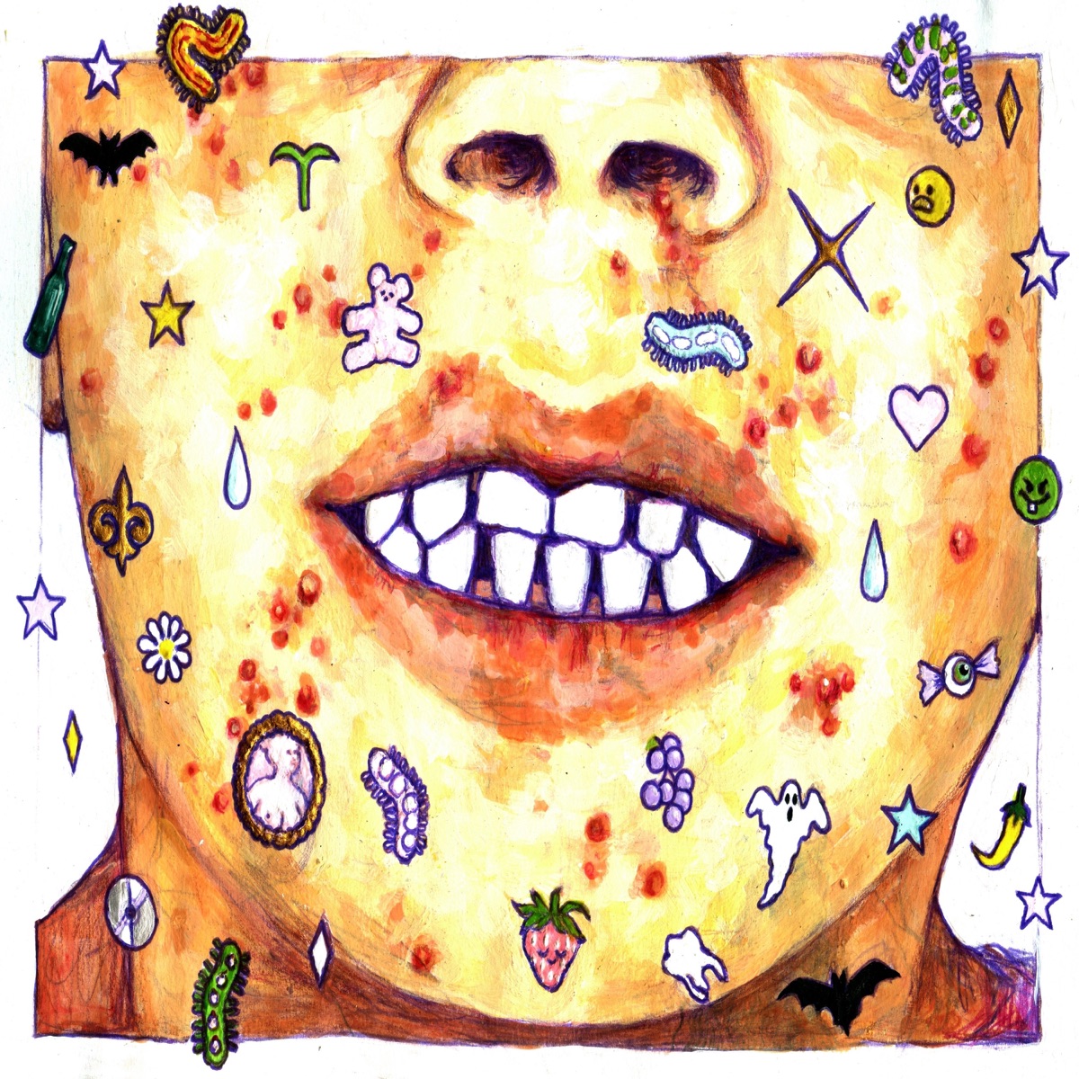 Acné by Nocauto album cover