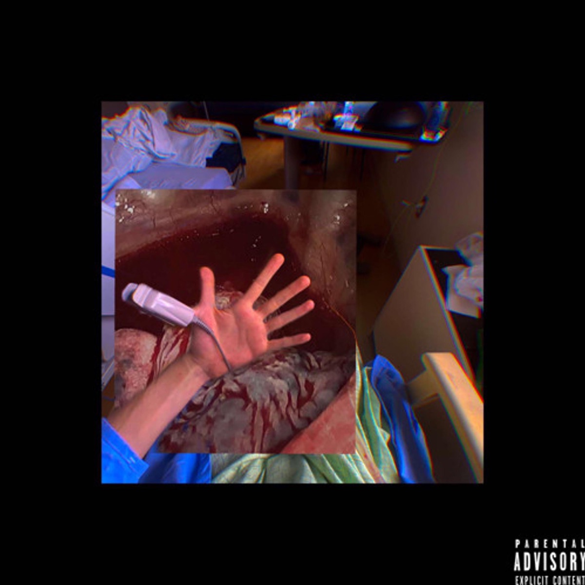 Stain - Single by Vitamjn album cover