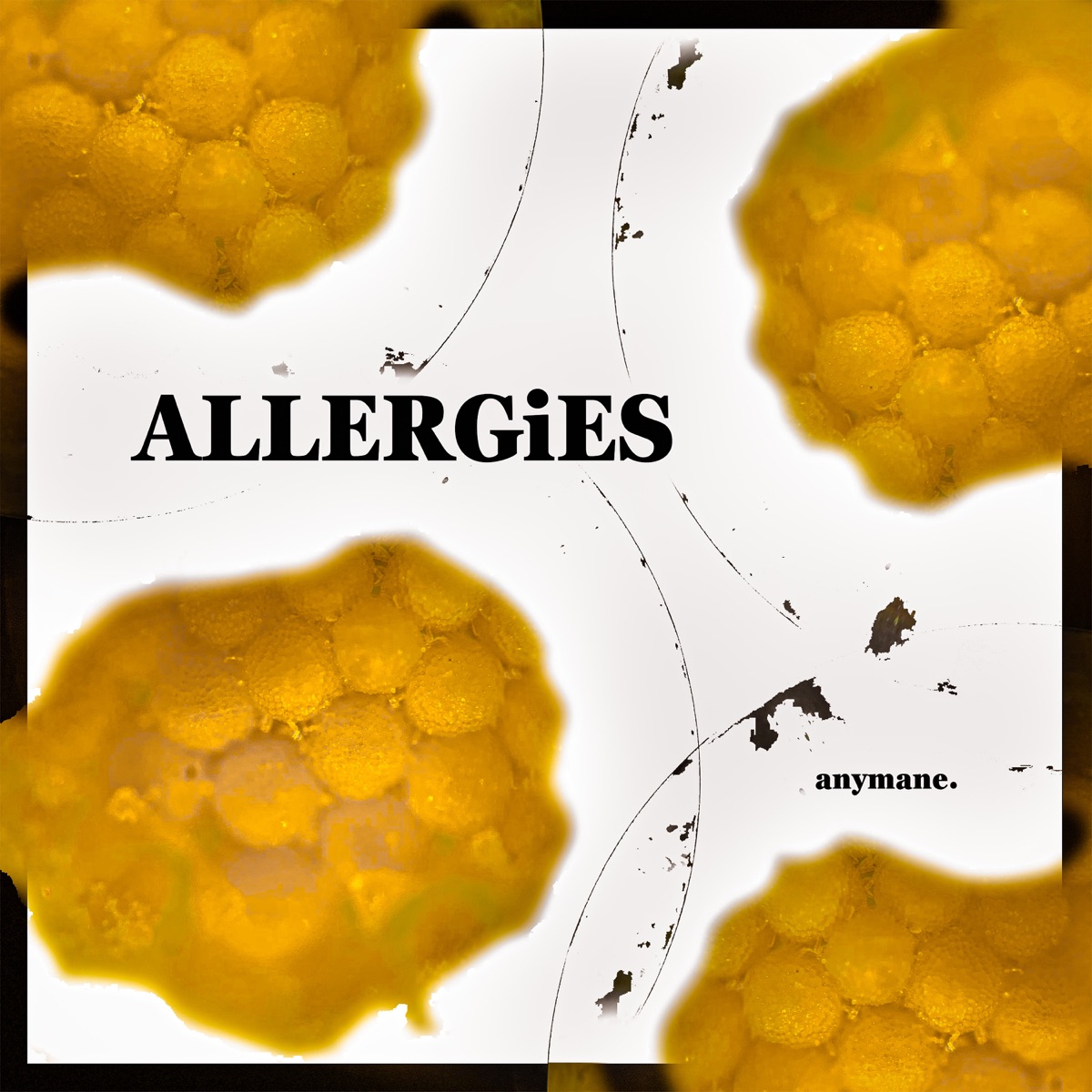 ALLERGiES - Single by anymane. album cover