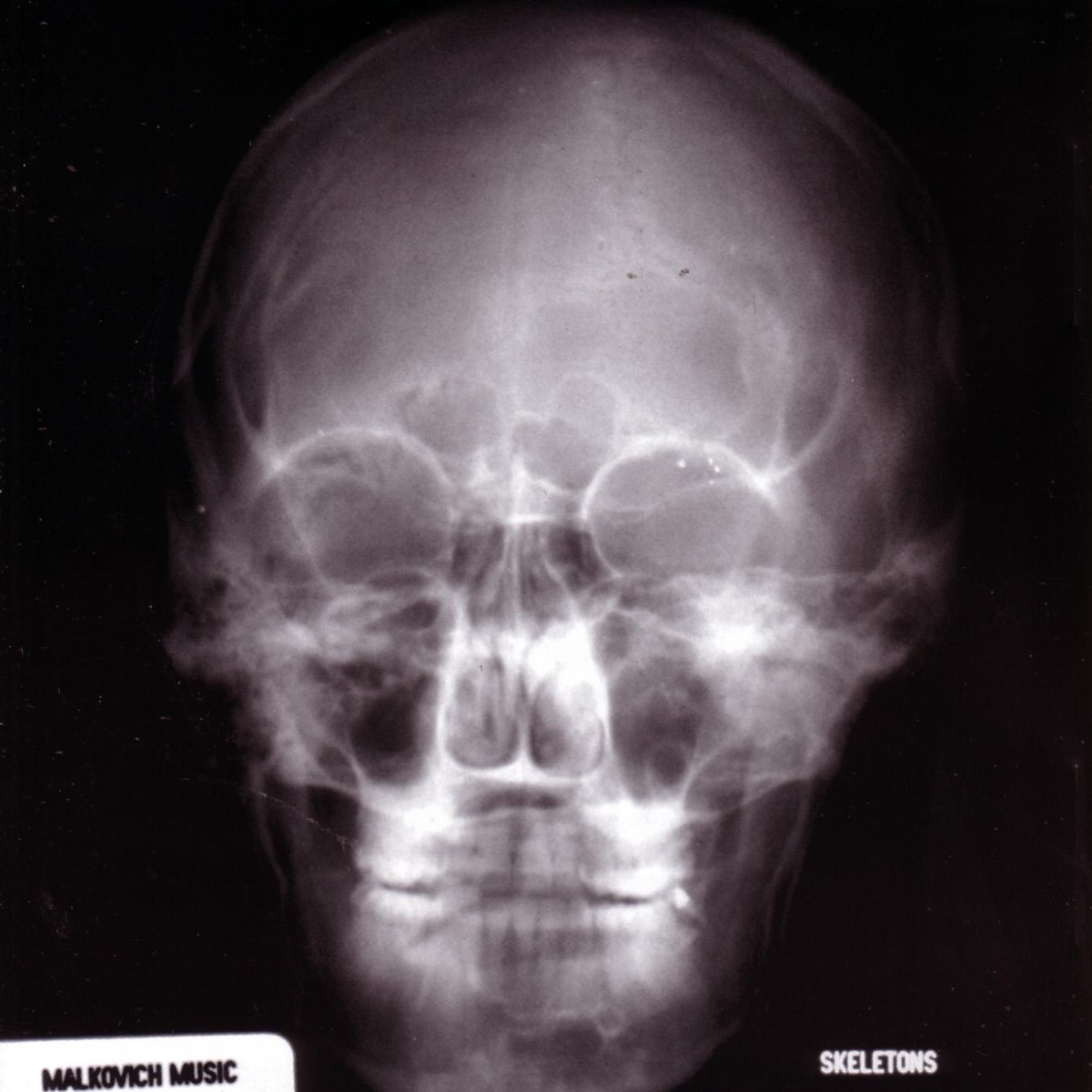 Skeletons by Malkovich Music album cover